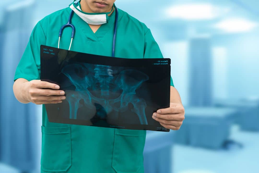 X-rays in Pregnancy